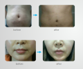 lipo plus.png